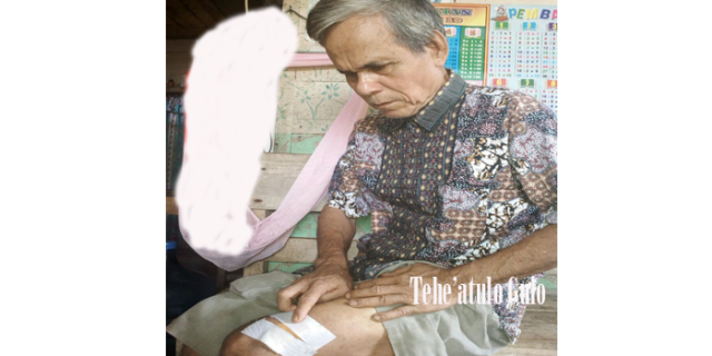 Tehe’atulo Gulo Dibacok dan Dianiaya Saat Pulang dari Gereja