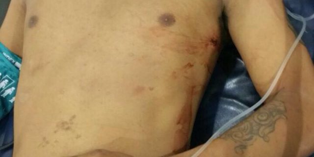 Dua Anggota Polisi Ditembak Curanmor