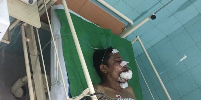 Sigit Sugiarto Kritis Dimassa