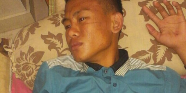 Oknum OKP Aniaya Siswa SMP di Kota Gunungsitoli