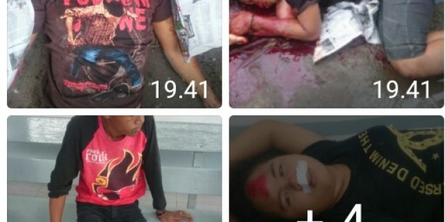 Belum Nikmati Hasil Jambretnya,Pelaku Ini Tewas Mengenaskan