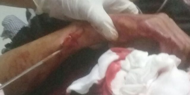 Ketum PPWI Minta Kapolres Bogor Tangkap Pelaku Pembegal Wartawan Metropol