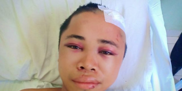 AJH Minta Polrestabes Medan Tangkap Pelaku Pengeroyokan Kepada Satuhati Sarumaha di Pasar MMTC