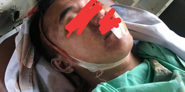 Kapendam I/BB: Kematian Oknum TNI AD di Binjai Masih Dalam Penyelidikan