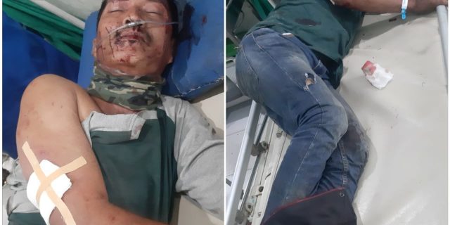 Bus Rajawali Seruduk Truk Colt Disel Di Jalan Tol, Begini Akhirnya