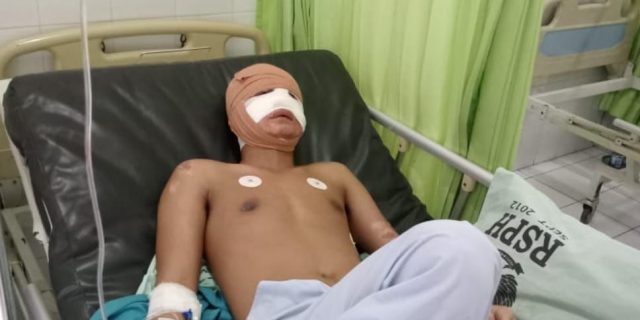 Usai Disiram Air Keras, Wartawan Ini Berstatus Terlapor di Polrestabes Medan