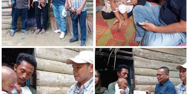 Sedulur Selawase Salurkan Bantuan Kapolres Langkat dan Donatur Untuk Bocah Penderita Tumor Mata