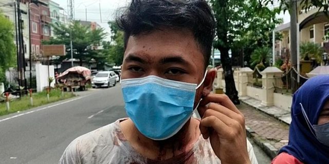 Dengan Kondisi Berlumuran Darah, Seorang Mahasiswa Mengadu ke Polrestabes Medan