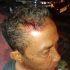 Hantam Kepala Pakai Batu, Korban Minta Polisi Segera Tangkap Para Pelaku Hantam Kepala Pakai Batu, Korban Minta Polisi Segera Tangkap Para Pelaku