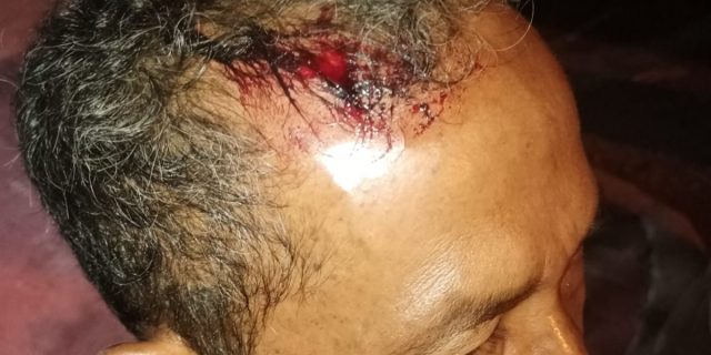 Hantam Kepala Pakai Batu, Korban Minta Polisi Segera Tangkap Para Pelaku Hantam Kepala Pakai Batu, Korban Minta Polisi Segera Tangkap Para Pelaku