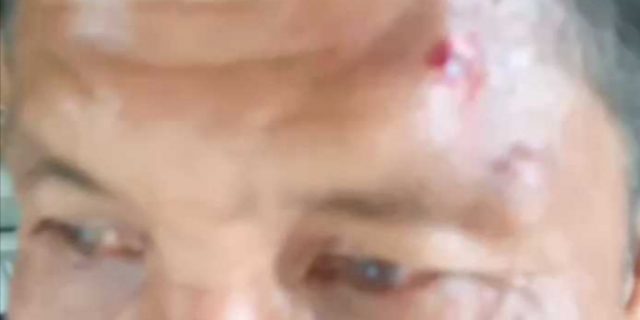 Diduga Dianiaya Preman, Korban Ditahan Polsek Percut Sei Tuan