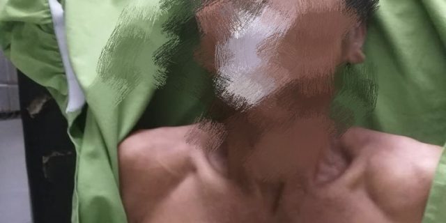 Malu Ketahuan Cabuli Putri Tirinya, Nainggolan Nenggak Racun Akhiri Hidup