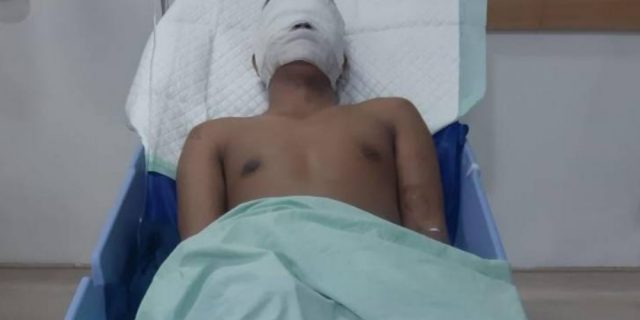 Gawat! Wartawan Disiram Air Keras di Sumut